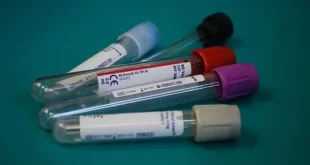 Where To Find Child's Blood Type Singapore